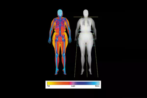 x ray image of a persons Body Composition
