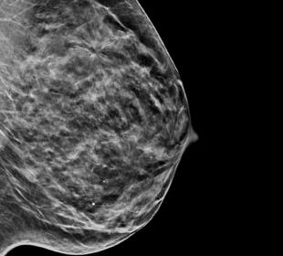 Hologic C-View™ Synthesized 2D Imaging in white background