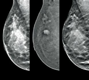 Hologic Hologic I-View™ Contrast Enhanced Imaging